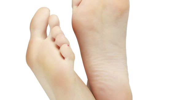 Pieds gonflés : les trucs et astuces qui fonctionnent vraiment
