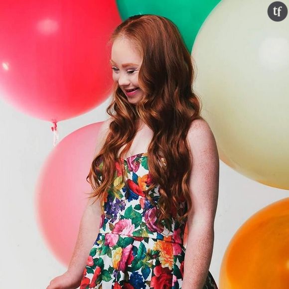 Madeline Stuart, le top modèle touché par la trisomie 21 participera à la Fashion Week de New York en septembre 2015