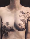 Un magnifique cover up de cicatrices post mastectomie.