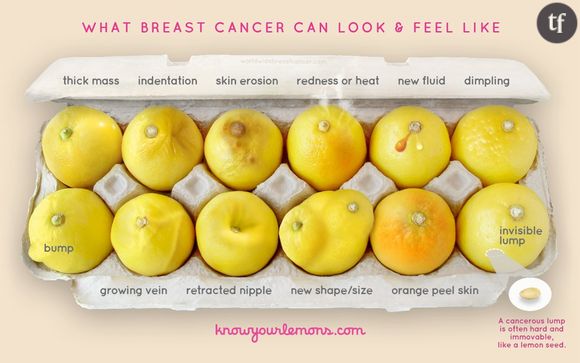 La campagne "Know Your Lemons" aide à détecter les symptômes du cancer du sein