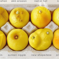 Ces citrons peuvent vous aider à détecter un cancer du sein