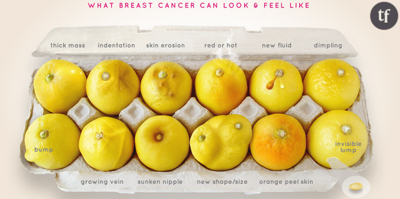 La campagne de prévention contre le cancer du sein "Know Your Lemons"