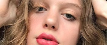 Albinisme Ces Mannequins Albinos Qui Defient Les Normes Terrafemina Albinisme Ces Mannequins Albinos Qui Defient Les Normes Terrafemina