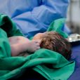 Au Portugal la mortalité infantile est à son taux le plus élevé depuis 2018, avec un chiffre considérable de de 23,9 %, "quatre fois supérieur à la moyenne de l'UE".