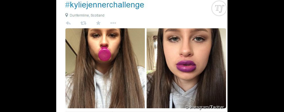 Kylie Jenner Challenge : certains participants ont pris le jeu très au sérieux