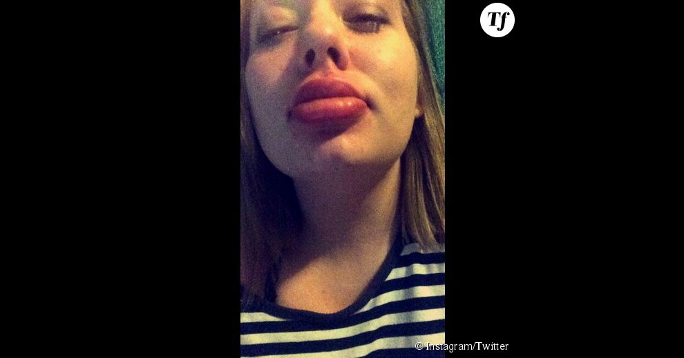 Kylie Jenner Challenge : des lèvres pulpeuses en seulement quelques minutes