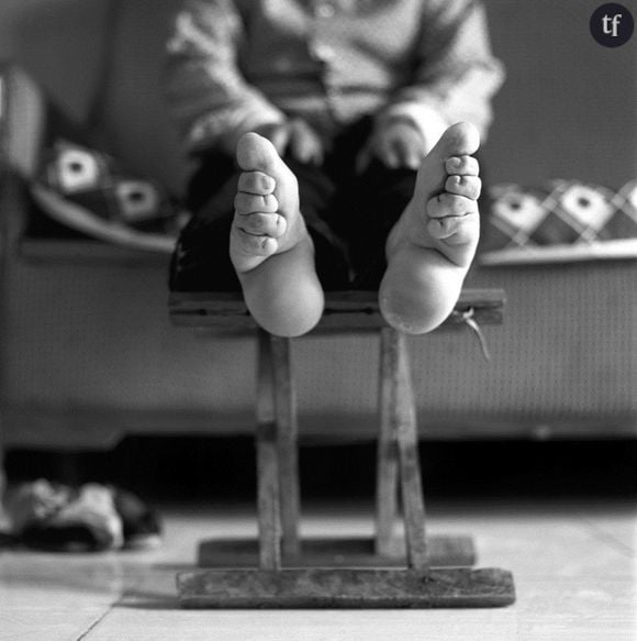 Photo d'une femme aux pieds bandés pour le projet "Living History" de la photographe Jo Farrell