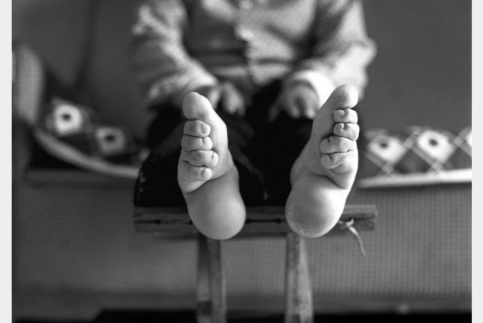 Photo d'une femme aux pieds bandés pour le projet "Living History" de la photographe Jo Farrell