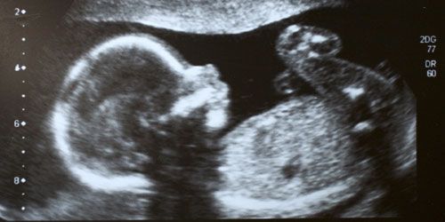 Grossesse : le foetus parvient à distinguer les voix dès six mois