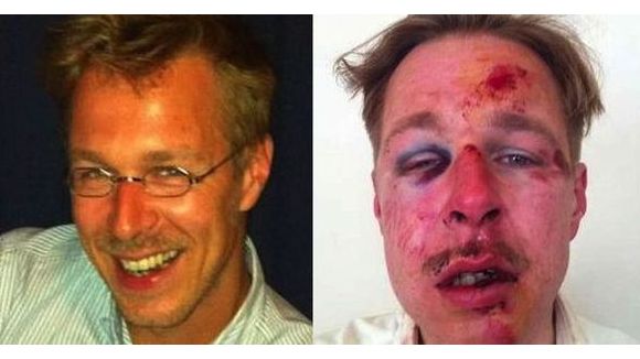 Homophobie : une photo choc pour dénoncer une violence grandissante