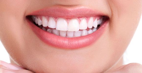 Blanchiment des dents : les produits les plus dangereux retirés du marché