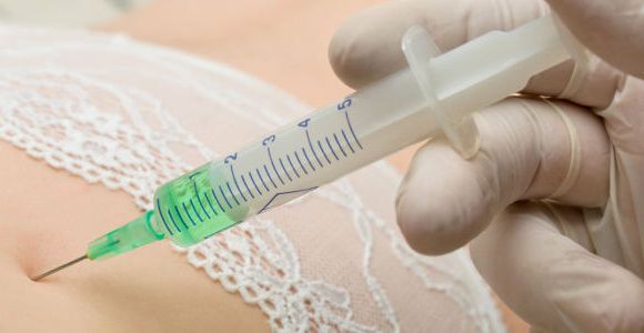 Injections aux bio-polymères : chirurgie esthétique désastreuse au Venezuela