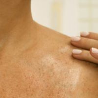 Cancer de la peau : Faites-vous dépister !