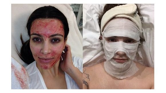 Instagram 2013 : les meilleurs et les pires selfies des people