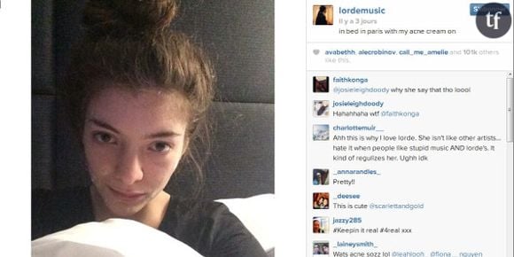 Lorde et sa crème anti-acné : le selfie qui fait du bien aux jeunes