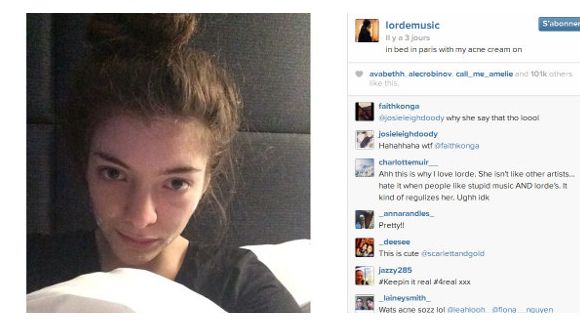 Lorde et sa crème anti-acné : le selfie qui fait du bien aux jeunes 