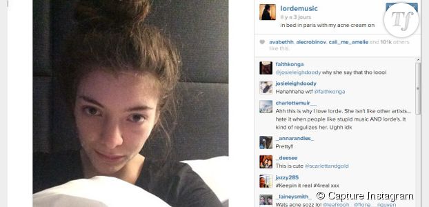 Lorde et sa crème anti-acné : le selfie qui fait du bien aux jeunes 