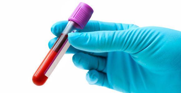 Un solvant industriel pour vaincre le cancer ?