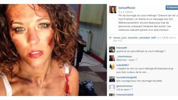 Lorie : totalement défigurée sur Instagram, pourquoi ? (Photo)