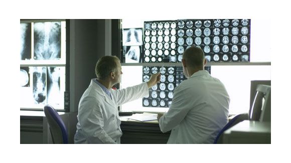 Pourra-t-on bientôt dépister les cancers du poumon ? 