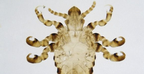 Alerte aux poux: le pic de l’épidémie prévu pour la fin août