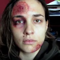 “Pomizite Mi”: un an de selfies contre les violences domestiques - video