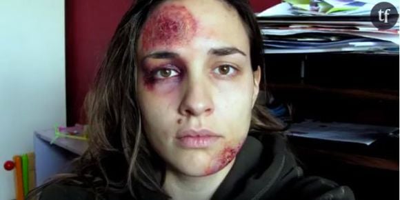 “Pomizite Mi”: un an de selfies contre les violences domestiques - video