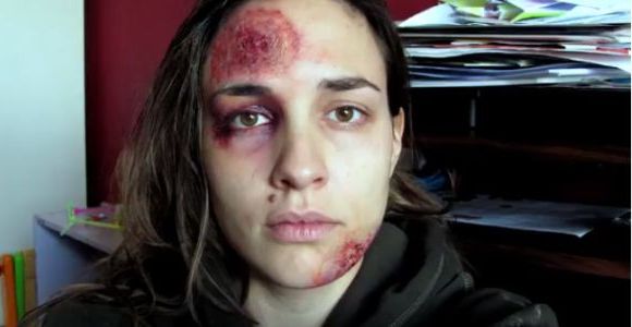 “Pomizite Mi”: un an de selfies contre les violences domestiques - video