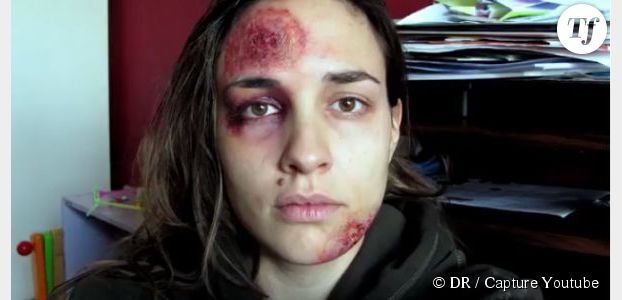 “Pomizite Mi”: un an de selfies contre les violences domestiques - video