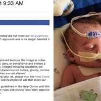 Facebook interdit la photo d’un bébé malade jugée "effrayante" 