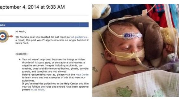 Facebook interdit la photo d’un bébé malade jugée "effrayante" 