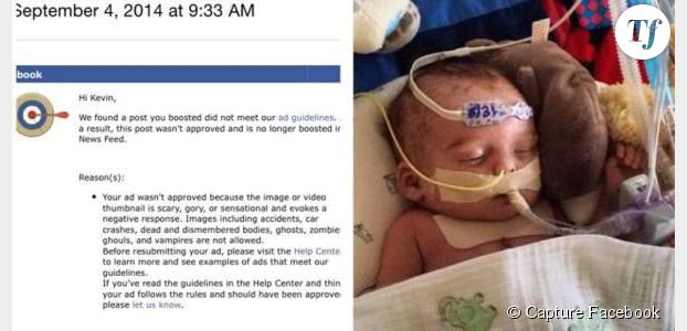 Facebook interdit la photo d’un bébé malade jugée "effrayante" 