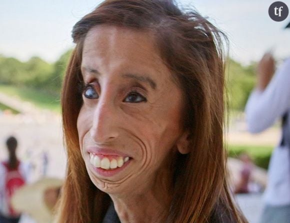 Lizzie Velasquez