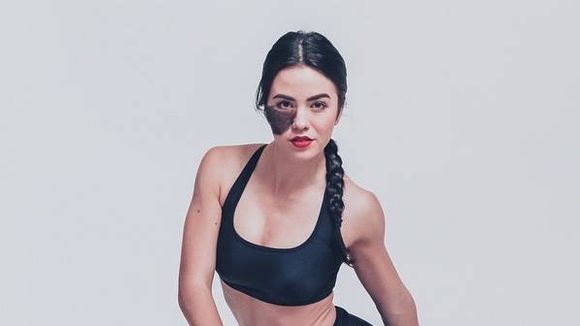 Sa tache de naissance aurait pu être un handicap : cette danseuse en a fait sa force