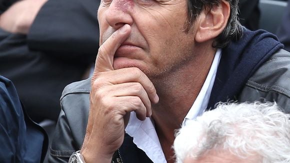 Jean-Luc Reichmann : l'animateur parle de sa tache sur le nez