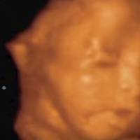 Une vidéo saisissante en 4D d'un bébé dans le ventre de sa maman