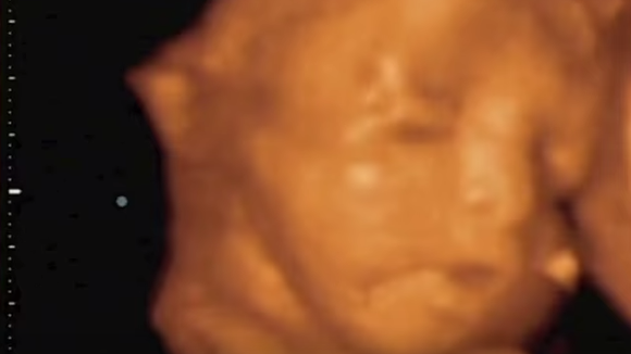 Une vidéo saisissante en 4D d'un bébé dans le ventre de sa maman