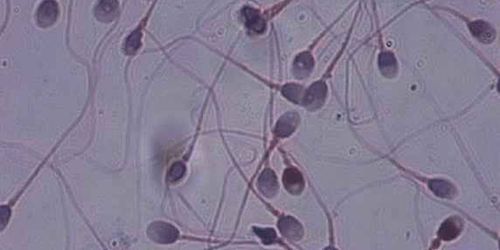 Trop de succès pour certains donneurs de sperme