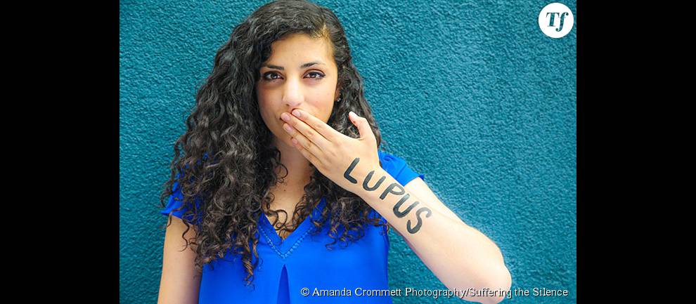 Erica Lupinacci, l&#039;une des deux jeunes femmes à l&#039;origine du projet, souffre d&#039;un lupus