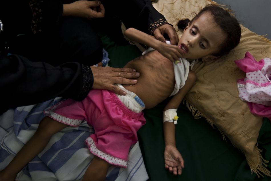 Famine au Yémen : la guerre oubliée qui fait mourir de faim des centaines de milliers d'enfants
