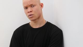 Menacé de mort en Sierra Leone, ce jeune albinos devient top model