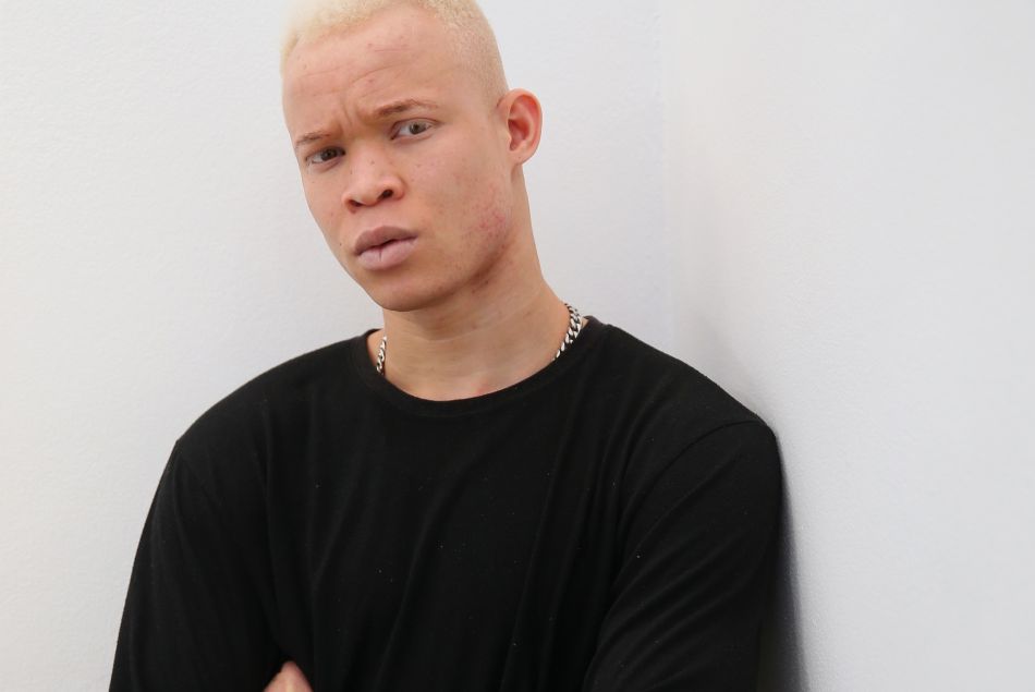 Le mannequin albinos Weah Bangura