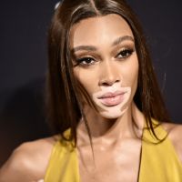 La mannequin Winnie Harlow défilera pour Victoria's Secret (et c'est réjouissant)