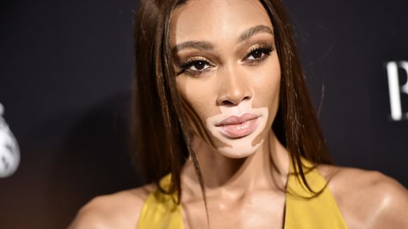 La mannequin Winnie Harlow défilera pour Victoria's Secret (et c'est réjouissant)