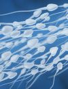         Les épidémiologistes               ont constaté qu'au cours de ces quarante-cinq années, la concentration moyenne de gamètes dans le sperme de la population masculine générale est passée de 101 millions par millilitre (M/ml) à 49 M/ml        