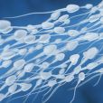         Les épidémiologistes               ont constaté qu'au cours de ces quarante-cinq années, la concentration moyenne de gamètes dans le sperme de la population masculine générale est passée de 101 millions par millilitre (M/ml) à 49 M/ml        