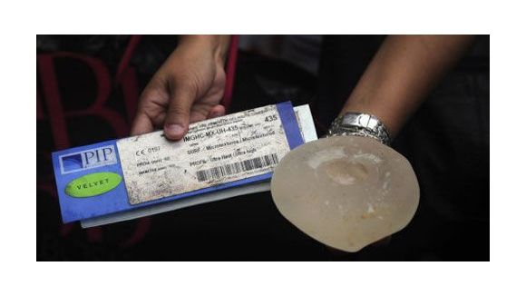 Prothèses mammaires PIP : l'OMS invite les femmes à consulter