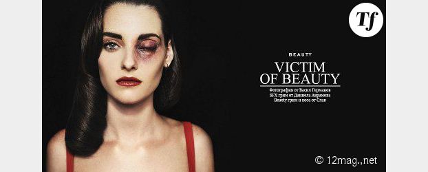 Violences conjugales : la femme battue comme image de mode