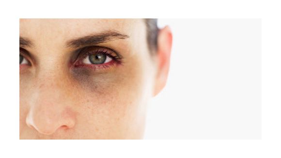 Violences conjugales : 4 fois plus de victimes chez les femmes pauvres