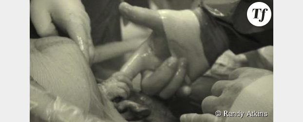 Un bébé serre le doigt d'un chirurgien avant d'être sorti du ventre de sa mère